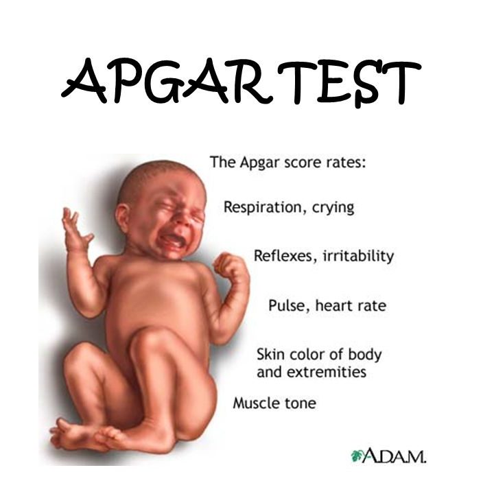 APGAR TEST