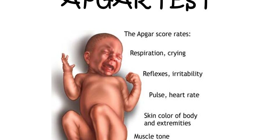 APGAR TEST