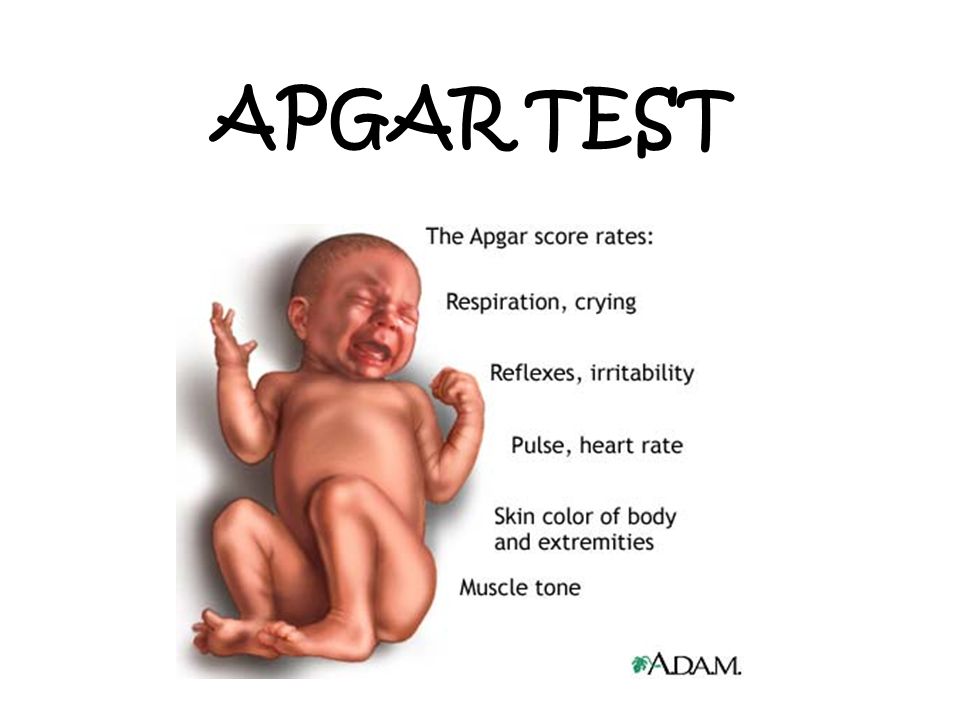APGAR TEST