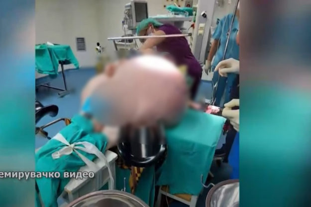 tumor 90 kg